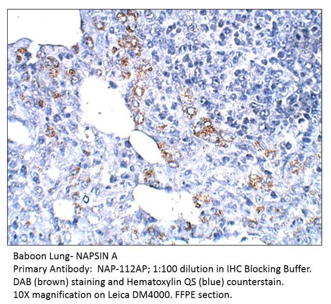 NAPSIN A Antibody in Immunohistochemistry (IHC)