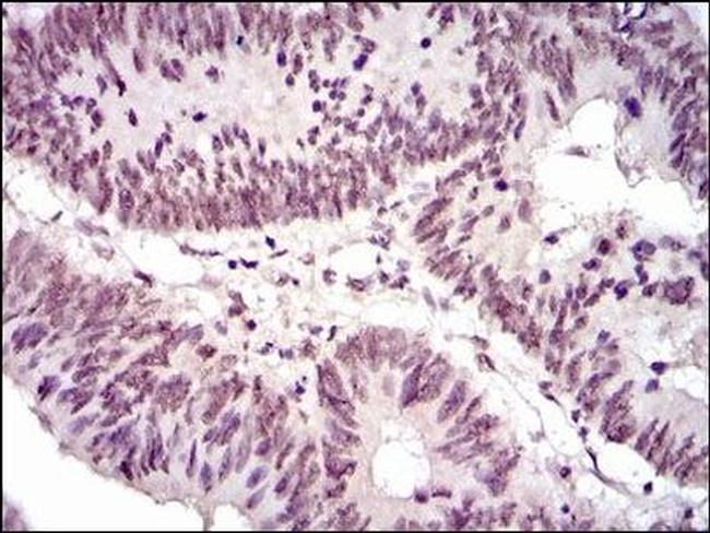 NCK1 Antibody in Immunohistochemistry (Paraffin) (IHC (P))