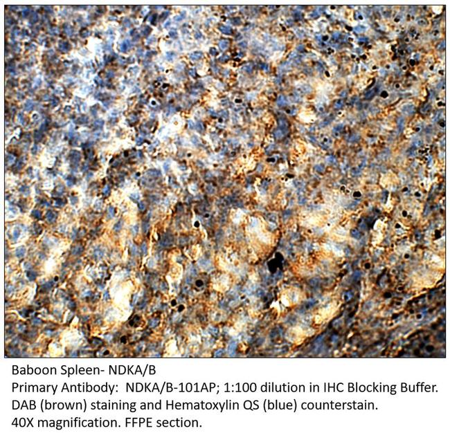 NME2 + NM23A Antibody in Immunohistochemistry (IHC)