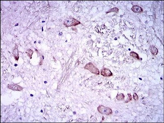 NF-H Antibody in Immunohistochemistry (Paraffin) (IHC (P))