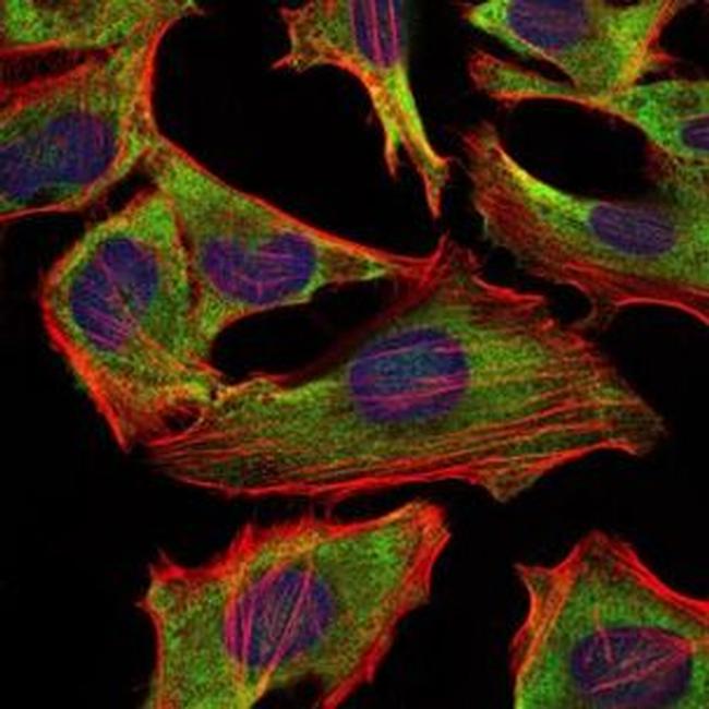 NEFL Antibody in Immunocytochemistry (ICC/IF)