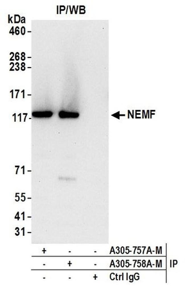 NEMF Antibody in Immunoprecipitation (IP)