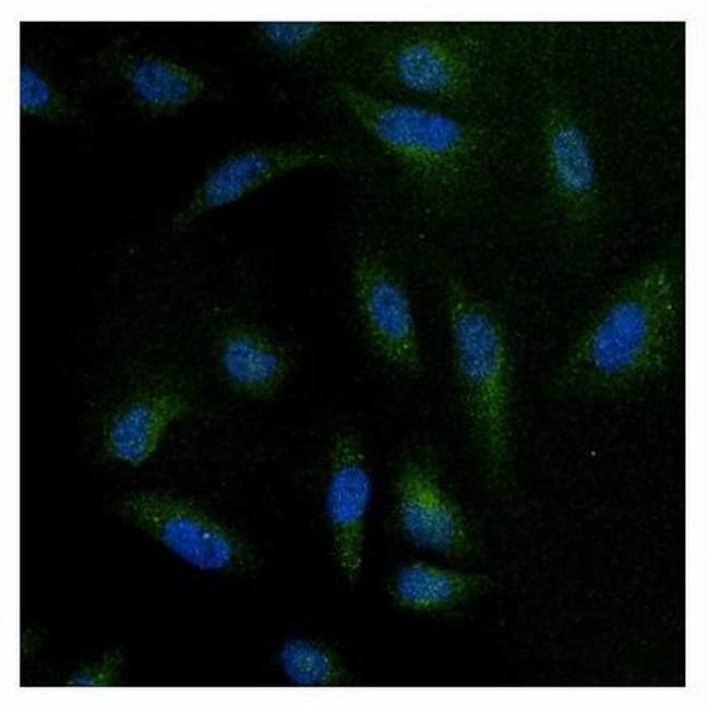 NFATC4 Antibody in Immunocytochemistry (ICC/IF)