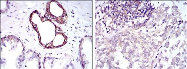 NFkB p50 Antibody in Immunohistochemistry (Paraffin) (IHC (P))