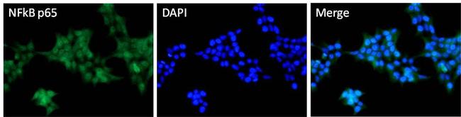 NFkB p65 Antibody in Immunocytochemistry (ICC/IF)