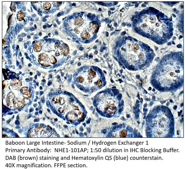 Sodium/Hydrogen Exchanger 1 Antibody in Immunohistochemistry (IHC)