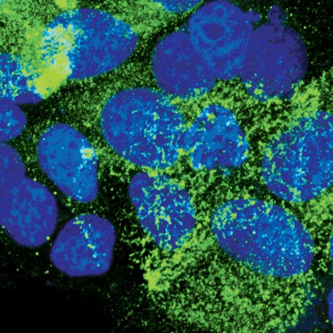 EBP50 Antibody in Immunocytochemistry (ICC/IF)