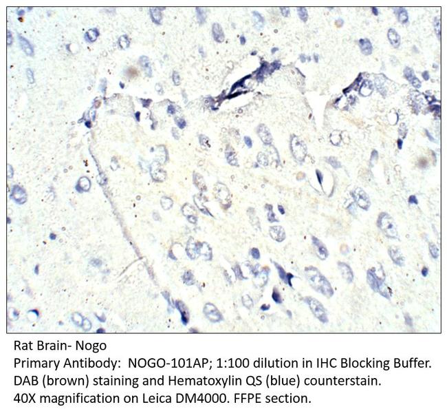 Nogo Antibody in Immunohistochemistry (IHC)