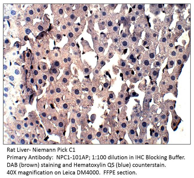 Niemann Pick C1 Antibody in Immunohistochemistry (IHC)