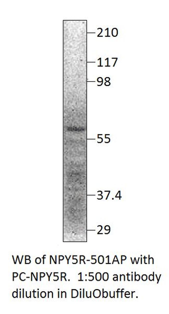 NPY5R Antibody in Western Blot (WB)