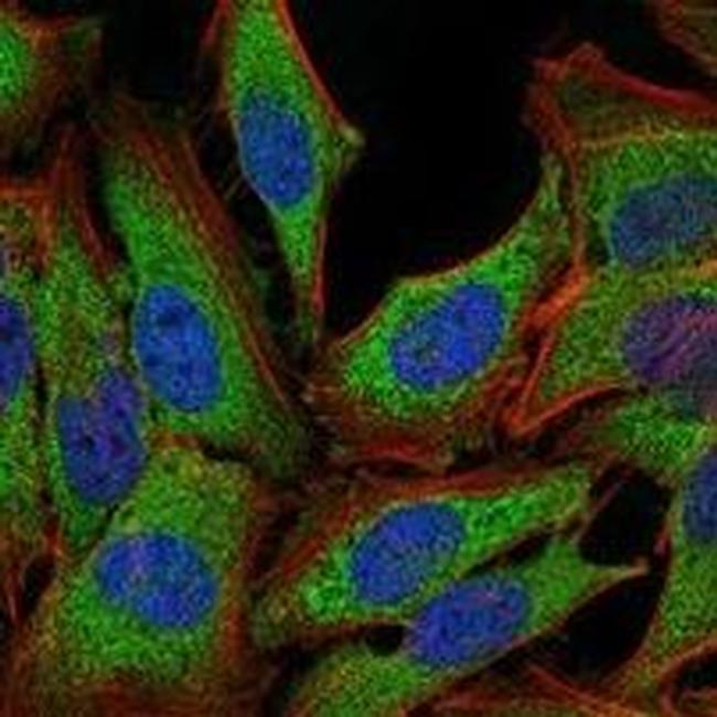 Glucocorticoid Receptor Antibody in Immunocytochemistry (ICC/IF)