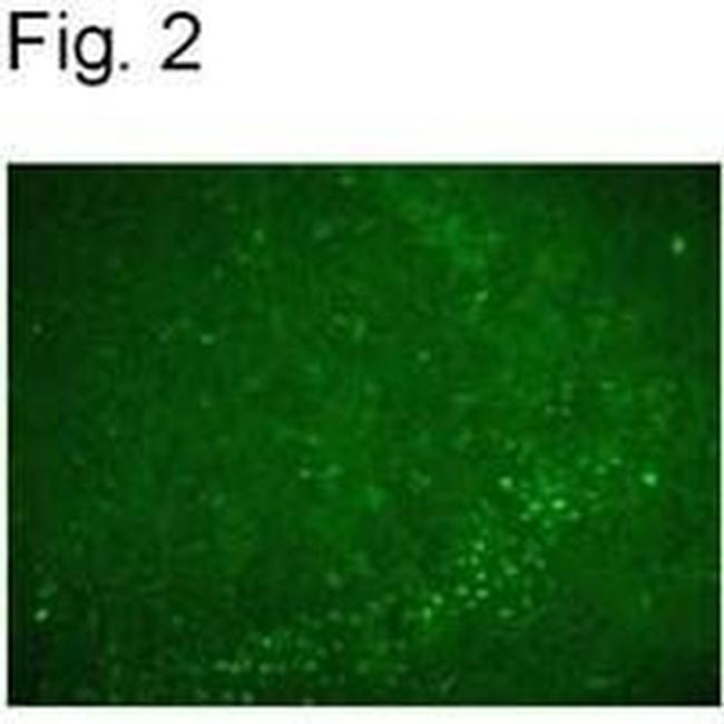 Nurr1 Antibody in Immunohistochemistry (IHC)