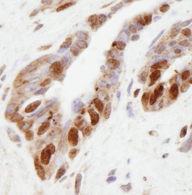 NSD1 Antibody in Immunohistochemistry (IHC)