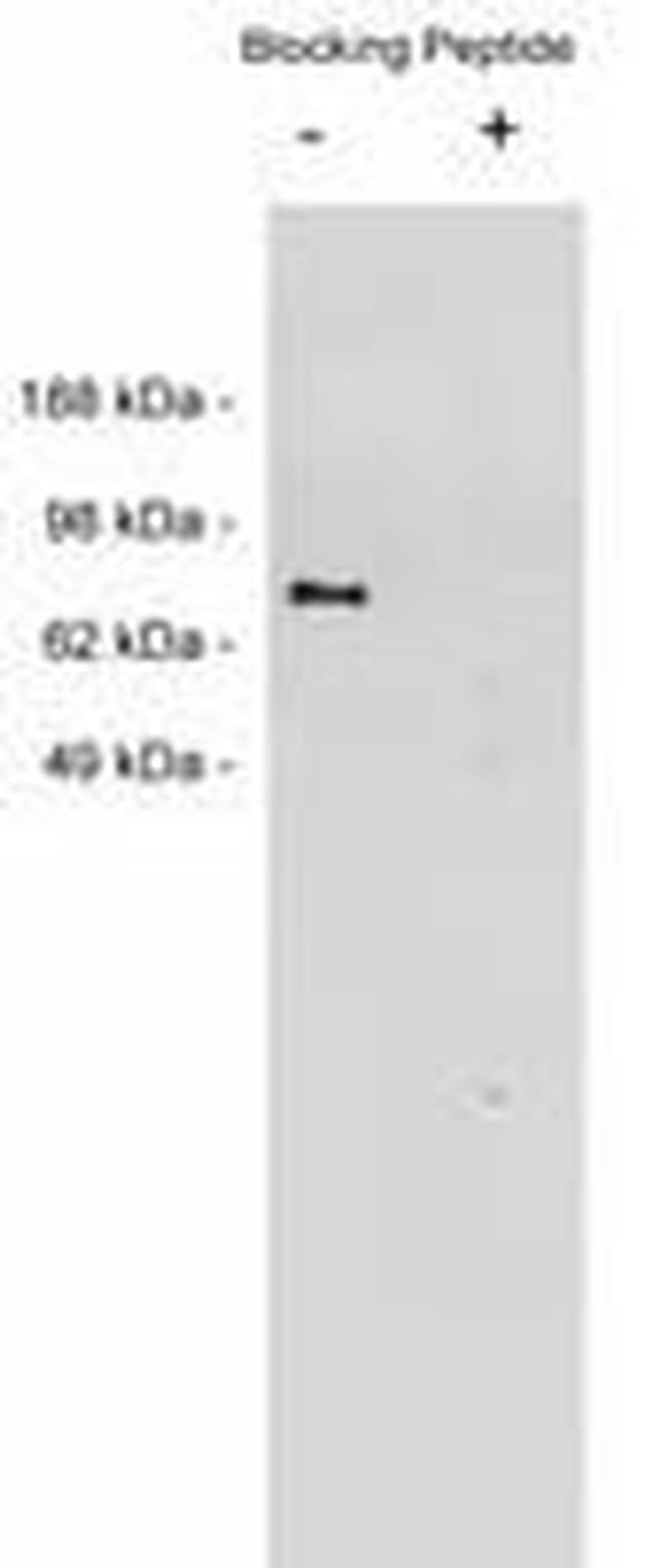 NTN1 Antibody in Western Blot (WB)