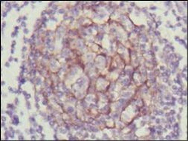 TrkC Antibody in Immunohistochemistry (Paraffin) (IHC (P))