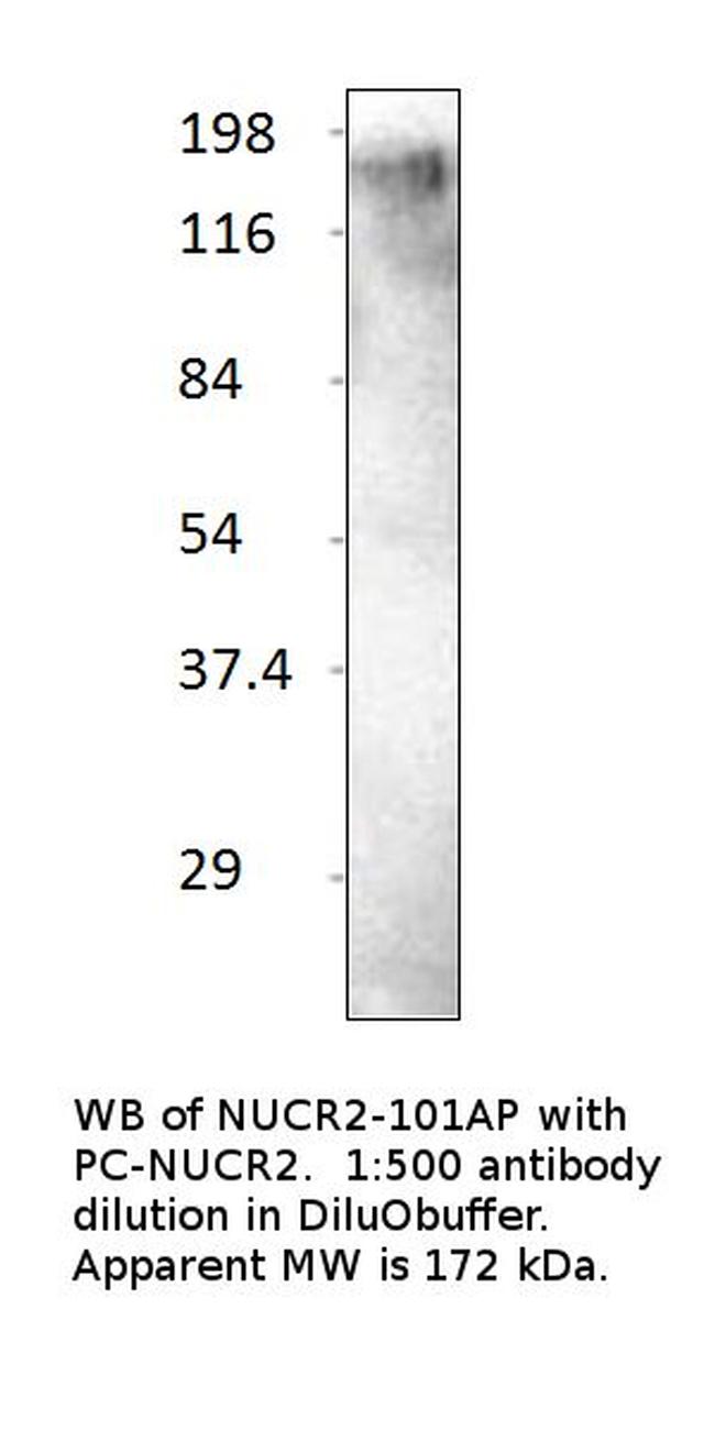 KAT13C/NCOA2 Antibody in Western Blot (WB)