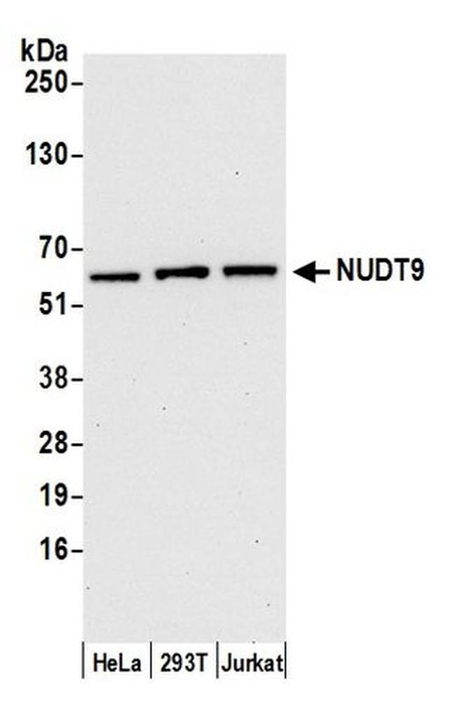 NUDT9 Antibody in Western Blot (WB)