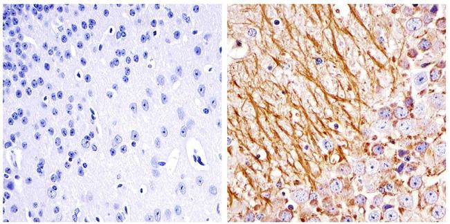 NEFL Antibody in Immunohistochemistry (Paraffin) (IHC (P))