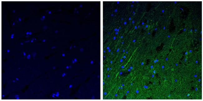 NEFM Antibody in Immunohistochemistry (Paraffin) (IHC (P))