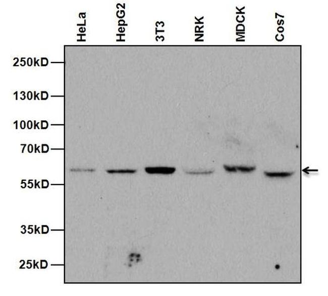 NUP62 Antibody in Western Blot (WB)