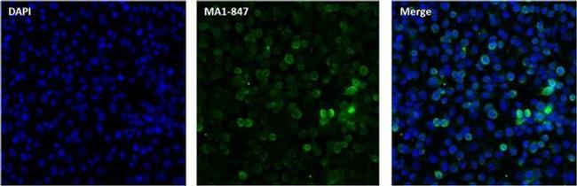 RANBP2 Antibody in Immunocytochemistry (ICC/IF)