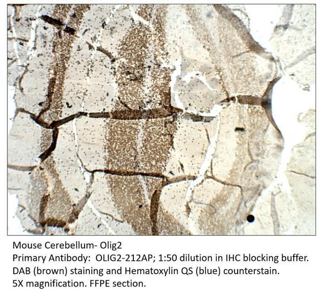 Olig2 Antibody in Immunohistochemistry (IHC)