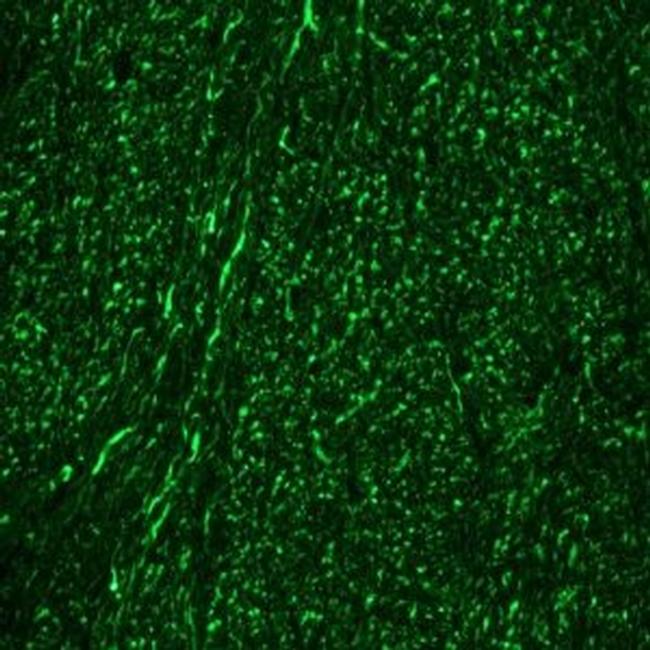 NEFM Antibody in Immunohistochemistry (Frozen) (IHC (F))