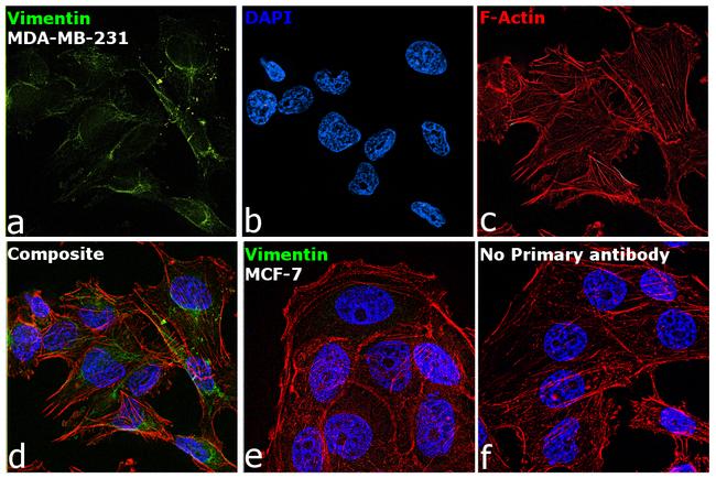 Vimentin Antibody in Immunocytochemistry (ICC/IF)