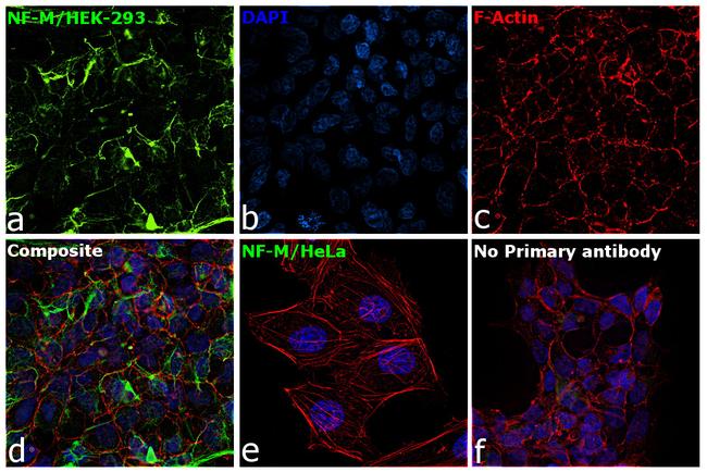 NEFM Antibody in Immunocytochemistry (ICC/IF)