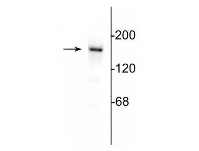 NMDAR2B Antibody in Western Blot (WB)