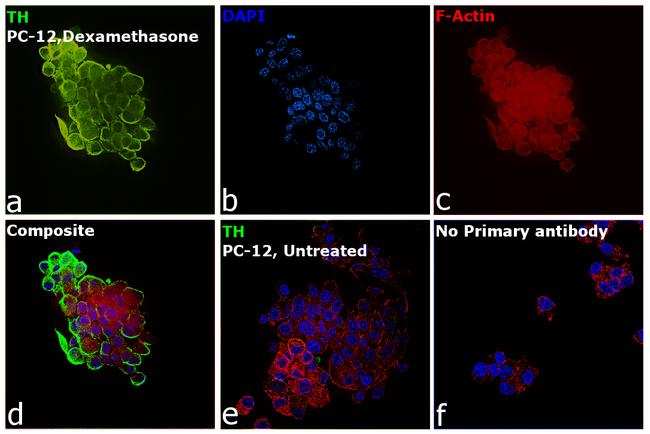 Tyrosine Hydroxylase Antibody in Immunocytochemistry (ICC/IF)