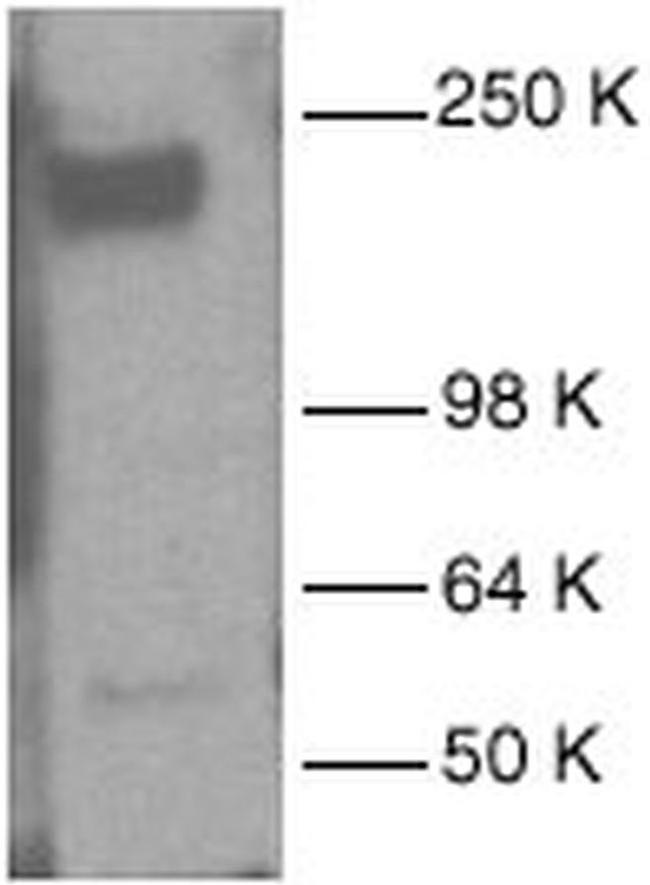 EGFR Antibody in Western Blot (WB)