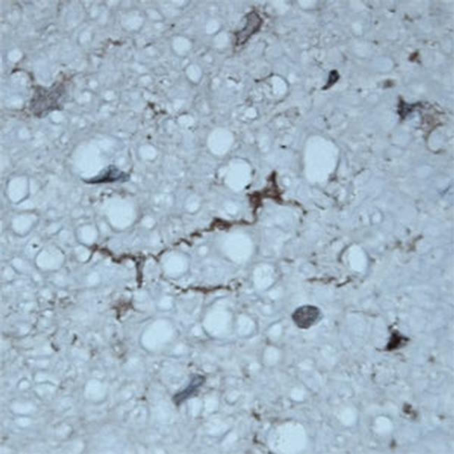 ATG16L1 Antibody in Immunohistochemistry (Paraffin) (IHC (P))