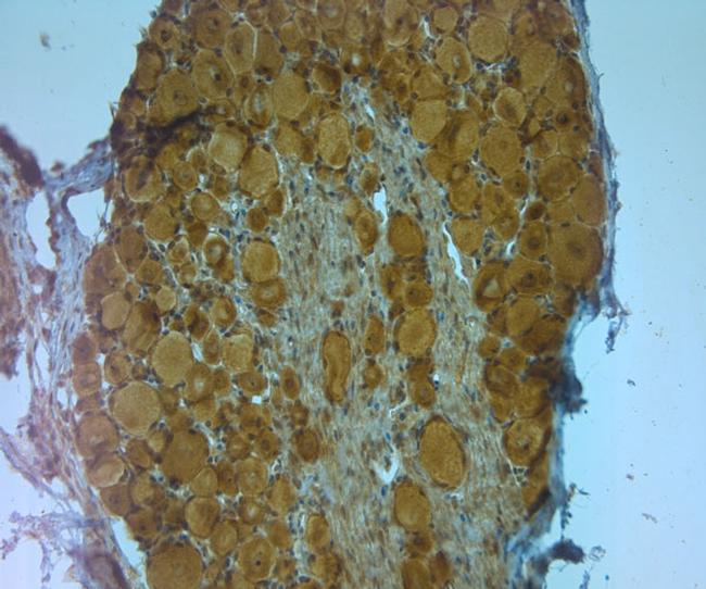 APP Antibody in Immunohistochemistry (Paraffin) (IHC (P))