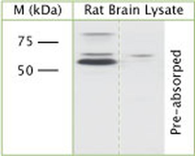 pan AKT Antibody in Western Blot (WB)