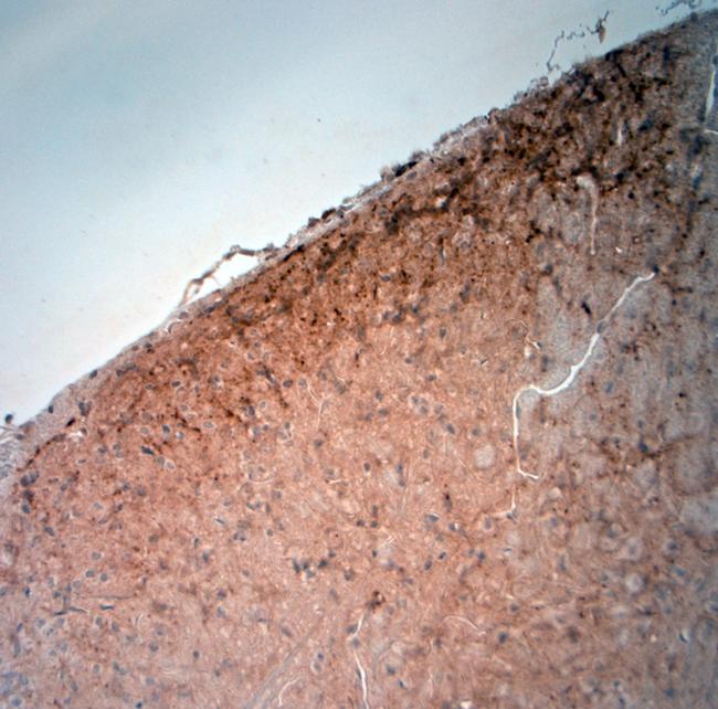 extracellular ASIC3 Antibody in Immunohistochemistry (Paraffin) (IHC (P))