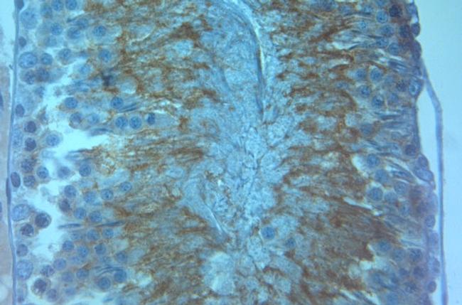 AQP8 Antibody in Immunohistochemistry (Paraffin) (IHC (P))