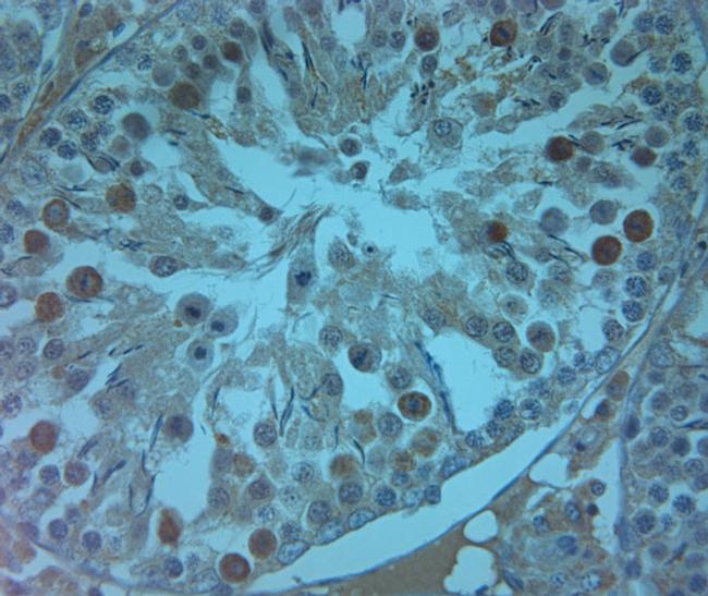 AQP9 Antibody in Immunohistochemistry (IHC)