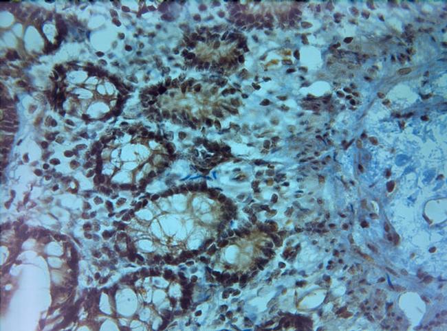 ATP8B1 Antibody in Immunohistochemistry (Paraffin) (IHC (P))