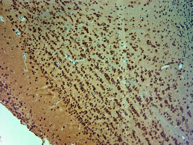 ARX Antibody in Immunohistochemistry (Paraffin) (IHC (P))