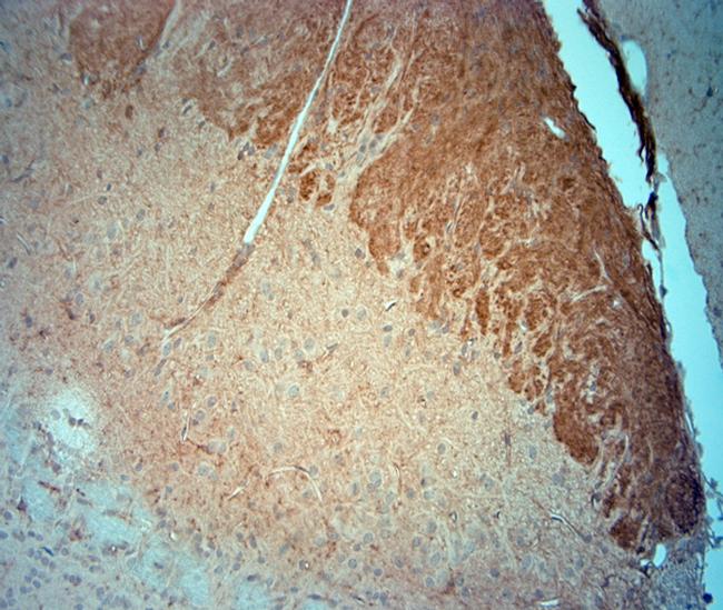 CACNA2D3 Antibody in Immunohistochemistry (Paraffin) (IHC (P))