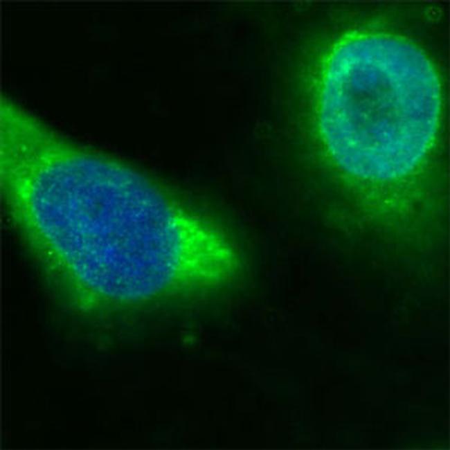 CD36 Antibody in Immunocytochemistry (ICC/IF)