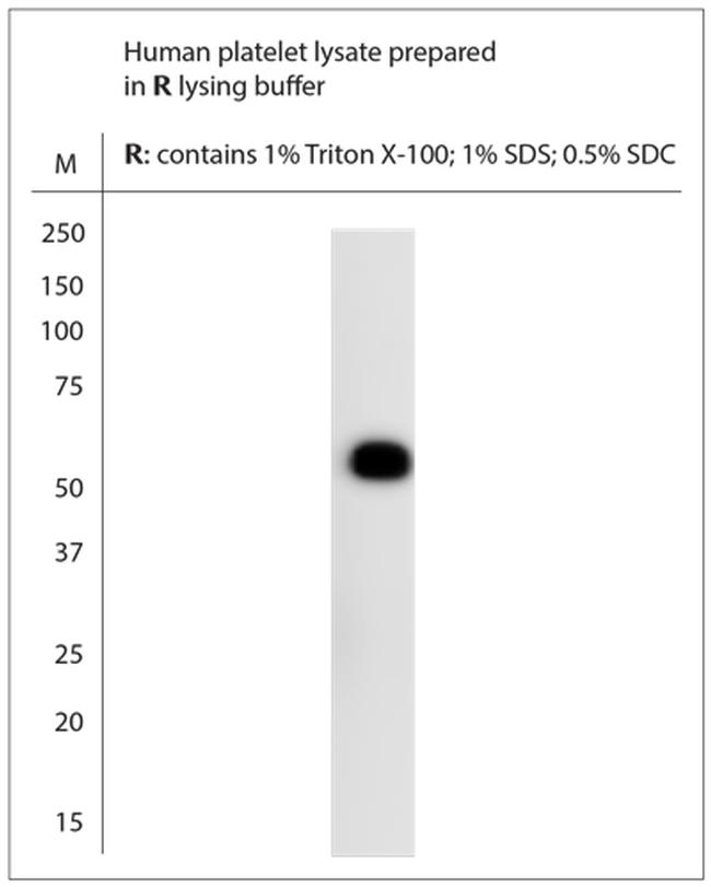 CYPIB1 Antibody in Western Blot (WB)