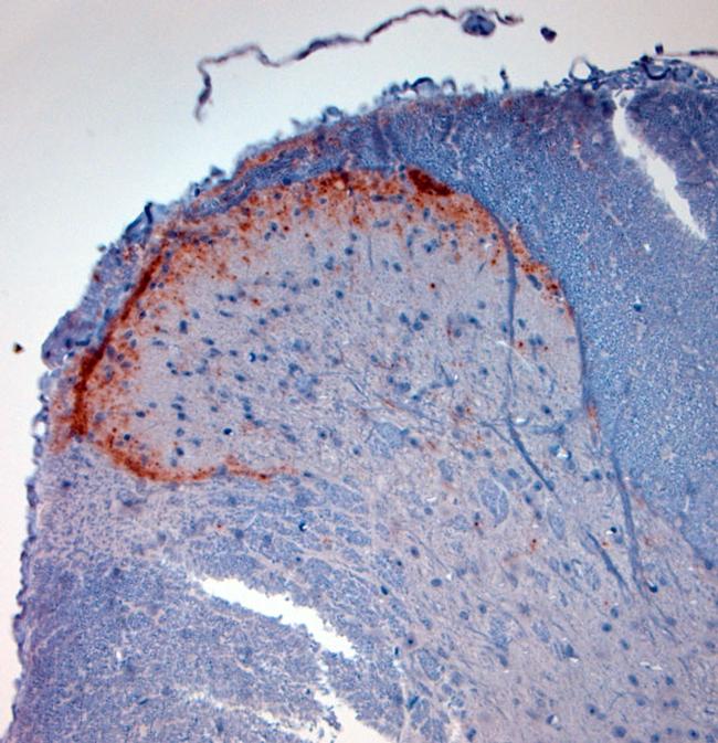 CGRP Antibody in Immunohistochemistry (Paraffin) (IHC (P))