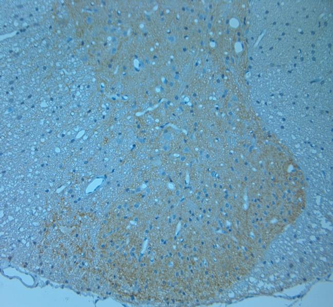 CSP Antibody in Immunohistochemistry (Paraffin) (IHC (P))