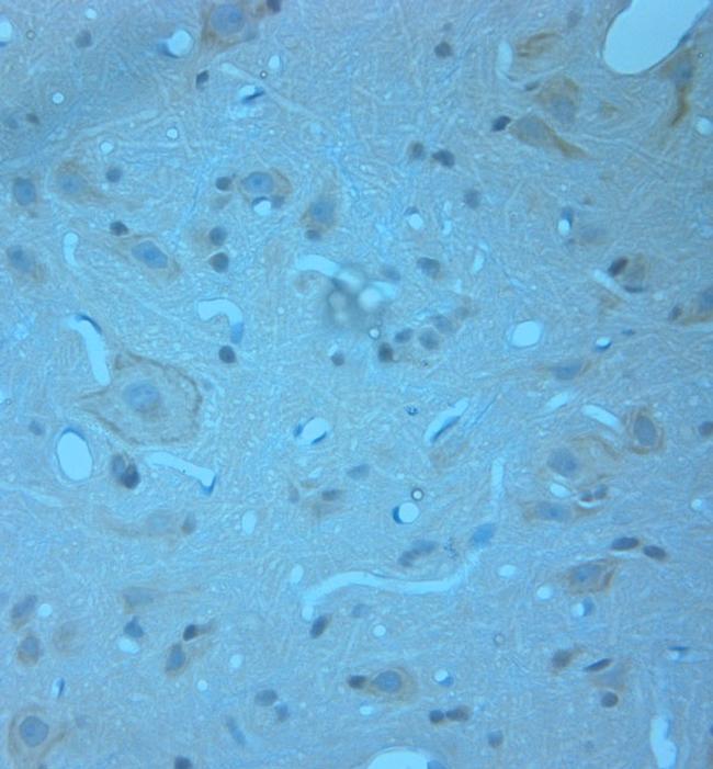 RCAN2 Antibody in Immunohistochemistry (Paraffin) (IHC (P))