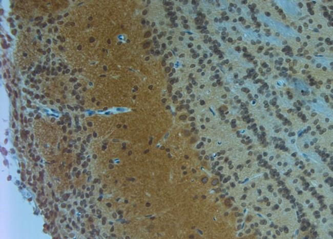 Clavesin 1 Antibody in Immunohistochemistry (Paraffin) (IHC (P))