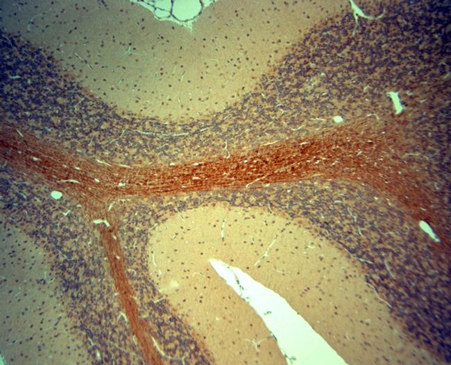 ChAT Antibody in Immunohistochemistry (Paraffin) (IHC (P))