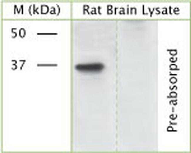 Phospho-GAP43 (Ser41) Antibody in Western Blot (WB)