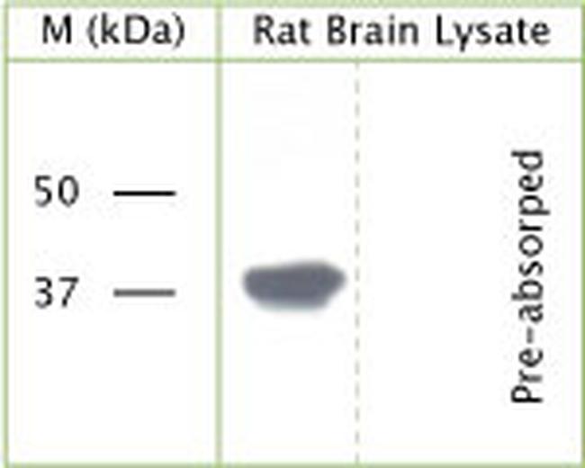 Phospho-GAP43 (Ser41) Antibody in Western Blot (WB)